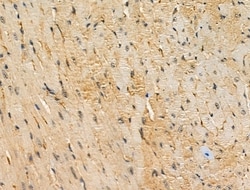 Invitrogen PAT1 Polyclonal Antibody 100 &mu;L; Unconjugated:Antibodies,