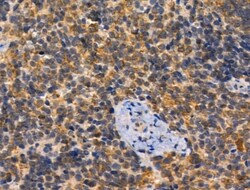 Invitrogen PAT1 Polyclonal Antibody 100 &mu;L; Unconjugated:Antibodies,