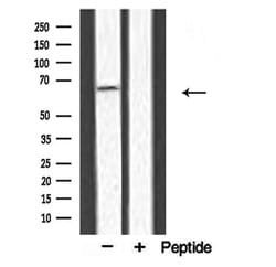 Invitrogen PAT1 Polyclonal Antibody 100 &mu;L; Unconjugated:Antibodies,