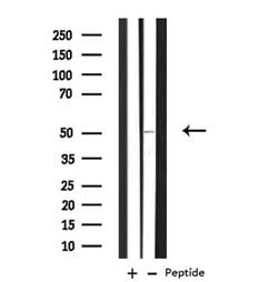 Invitrogen TMEM237 Polyclonal Antibody 100 μL; Unconjugated:Antibodies,