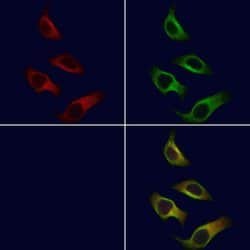 Invitrogen ARMC6 Polyclonal Antibody 100 &mu;L; Unconjugated:Antibodies,