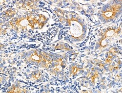 Invitrogen ARMC6 Polyclonal Antibody 100 &mu;L; Unconjugated:Antibodies,