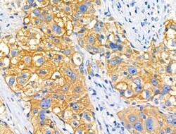 Invitrogen ARMC6 Polyclonal Antibody 100 &mu;L; Unconjugated:Antibodies,