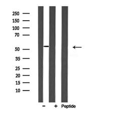 Invitrogen ARMC6 Polyclonal Antibody 100 &mu;L; Unconjugated:Antibodies,