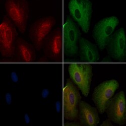 Invitrogen ATXN2L Polyclonal Antibody 100 &mu;L; Unconjugated:Antibodies,