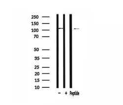 Invitrogen ATXN2L Polyclonal Antibody 100 &mu;L; Unconjugated:Antibodies,