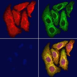 Invitrogen ABCA6 Polyclonal Antibody 100 &mu;L; Unconjugated:Antibodies,