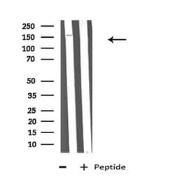 Invitrogen ABCA6 Polyclonal Antibody 100 &mu;L; Unconjugated:Antibodies,