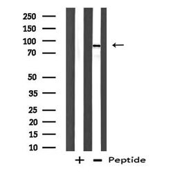 Invitrogen DDX54 Polyclonal Antibody 100 &mu;L; Unconjugated:Antibodies,