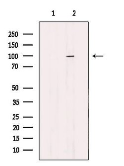 Invitrogen DDX54 Polyclonal Antibody 100 &mu;L; Unconjugated:Antibodies,