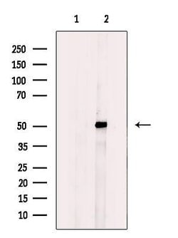 Invitrogen GCNT7 Polyclonal Antibody 100 μL; Unconjugated:Antibodies,