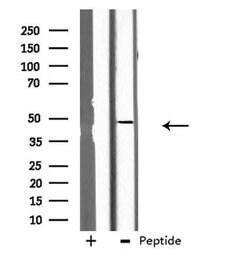Invitrogen GCNT7 Polyclonal Antibody 100 μL; Unconjugated:Antibodies,