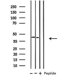 Invitrogen B4GALT1 Polyclonal Antibody 100 &mu;L; Unconjugated:Antibodies,