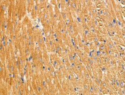 GUSB Polyclonal Antibody:Antibodies, Polyclonal