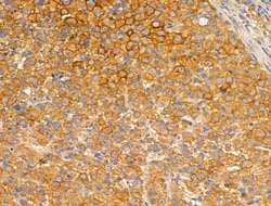 GUSB Polyclonal Antibody:Antibodies, Polyclonal