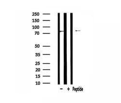 GUSB Polyclonal Antibody:Antibodies, Polyclonal