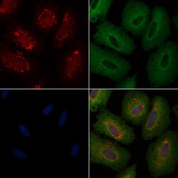 Invitrogen CHP1 Polyclonal Antibody 100 &mu;L; Unconjugated:Antibodies,