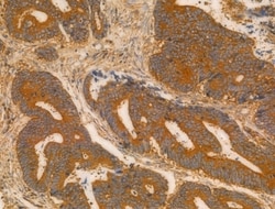 Invitrogen CHP1 Polyclonal Antibody 100 &mu;L; Unconjugated:Antibodies,