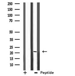 Invitrogen CHP1 Polyclonal Antibody 100 &mu;L; Unconjugated:Antibodies,