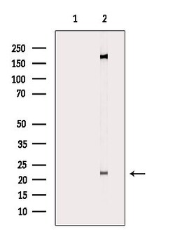 Invitrogen CHP1 Polyclonal Antibody 100 &mu;L; Unconjugated:Antibodies,