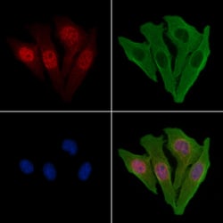 Invitrogen Calpain 10 Polyclonal Antibody 100 &mu;L; Unconjugated:Antibodies,
