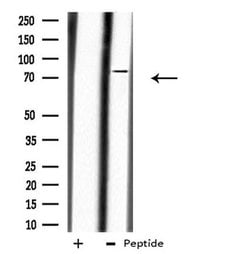 Invitrogen Calpain 10 Polyclonal Antibody 100 &mu;L; Unconjugated:Antibodies,