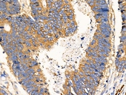 Invitrogen PDE4C Polyclonal Antibody 100 &mu;L | Buy Online | Invitrogen&trade; | Fisher Scientific