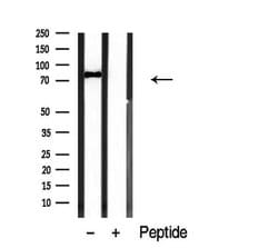 Invitrogen PDE4C Polyclonal Antibody 100 &mu;L | Buy Online | Invitrogen&trade; | Fisher Scientific