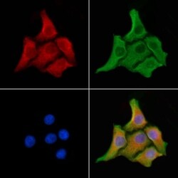 Invitrogen MRP2 Polyclonal Antibody 100 &mu;L; Unconjugated:Antibodies,
