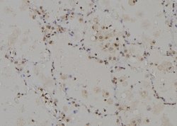 Invitrogen CAGE1 Polyclonal Antibody 100 &mu;L | Buy Online | Invitrogen&trade; | Fisher Scientific