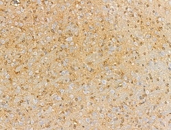 Invitrogen CAGE1 Polyclonal Antibody 100 &mu;L | Buy Online | Invitrogen&trade; | Fisher Scientific