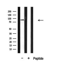 Invitrogen CAGE1 Polyclonal Antibody 100 &mu;L | Buy Online | Invitrogen&trade; | Fisher Scientific