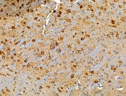 Invitrogen CLIP4 Polyclonal Antibody 100 &mu;L; Unconjugated:Antibodies,