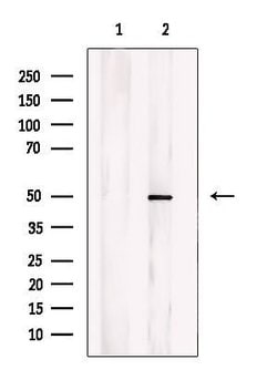 Invitrogen CHST1 Polyclonal Antibody 100 &mu;L; Unconjugated:Antibodies,