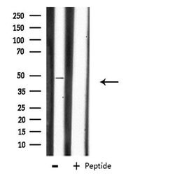 Invitrogen CHST1 Polyclonal Antibody 100 &mu;L; Unconjugated:Antibodies,