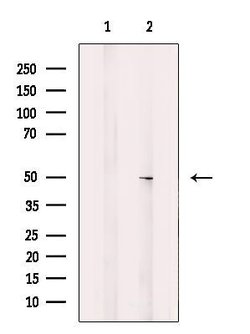 Invitrogen CHST10 Polyclonal Antibody 100 &mu;L | Buy Online | Invitrogen&trade; | Fisher Scientific