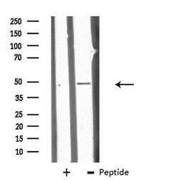 Invitrogen CHST10 Polyclonal Antibody 100 &mu;L | Buy Online | Invitrogen&trade; | Fisher Scientific