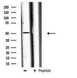 Invitrogen Carboxypeptidase A5 Polyclonal Antibody 100 &mu;L; Unconjugated:Antibodies,