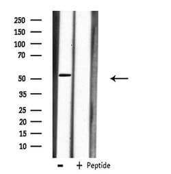 Invitrogen Carboxypeptidase M Polyclonal Antibody 100 &mu;L; Unconjugated:Antistoffer