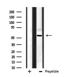 Invitrogen CPN2 Polyclonal Antibody 100 &mu;L; Unconjugated:Antibodies,
