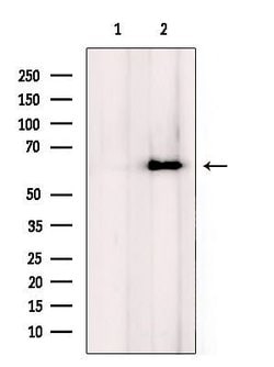 Invitrogen CPN2 Polyclonal Antibody 100 &mu;L; Unconjugated:Antibodies,