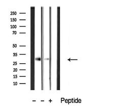 Invitrogen CTDSP1 Polyclonal Antibody 100 &mu;L; Unconjugated:Antibodies,