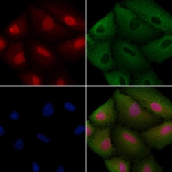 Invitrogen CEP57 Polyclonal Antibody 100 &mu;L; Unconjugated:Antibodies,