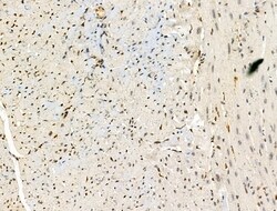 Invitrogen CEP57 Polyclonal Antibody 100 &mu;L; Unconjugated:Antibodies,
