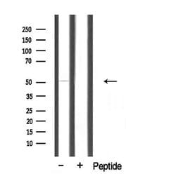 Invitrogen CEP57 Polyclonal Antibody 100 &mu;L; Unconjugated:Antibodies,