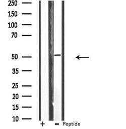 Cerebral Protein 1 Polyclonal Antibody:Antibodies, Polyclonal