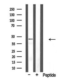 Invitrogen CLN5 Polyclonal Antibody 100 &mu;L; Unconjugated:Antibodies,