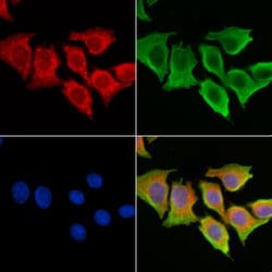 CLN6 Polyclonal Antibody, Invitrogen 100 &mu;L; Unconjugated:Antibodies,