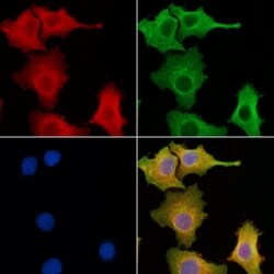 Invitrogen CLCC1 Polyclonal Antibody 100 μL; Unconjugated:Antibodies,