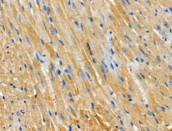Invitrogen CHSY1 Polyclonal Antibody 100 &mu;L; Unconjugated:Antibodies,